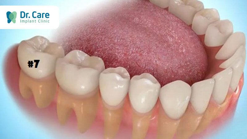 Răng là bộ phận quan trọng trong hệ tiêu hóa.
