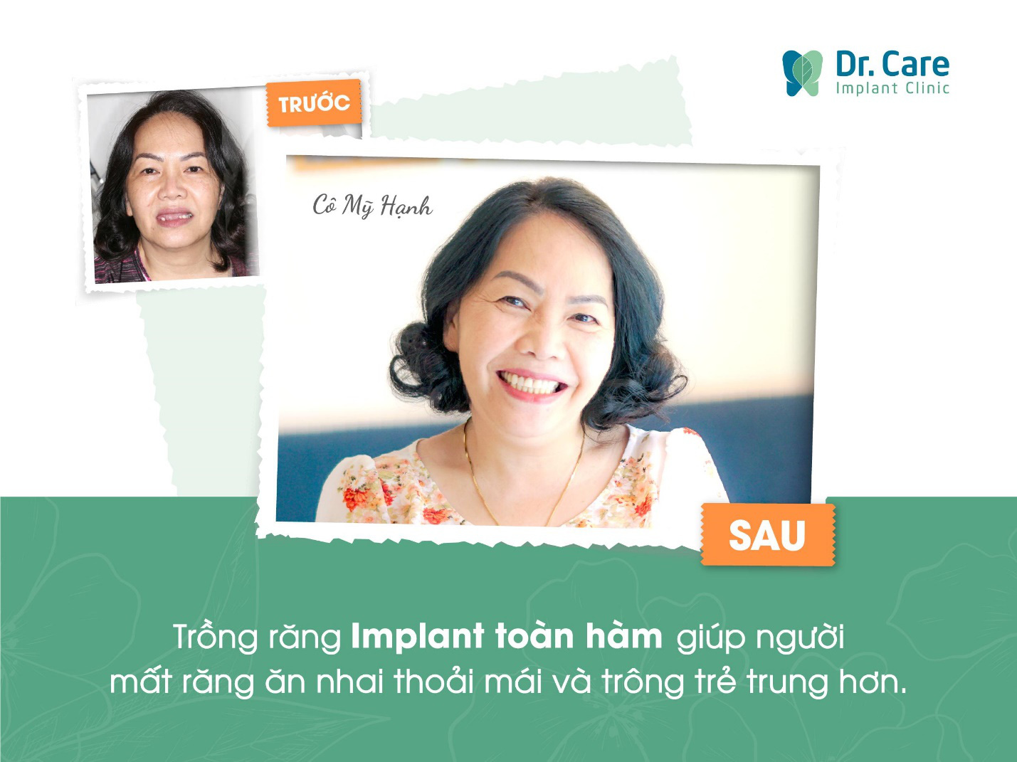 Nha khoa Dr. Care - Nha khoa chuyên sâu trồng Implant uy tín Bình Thạnh