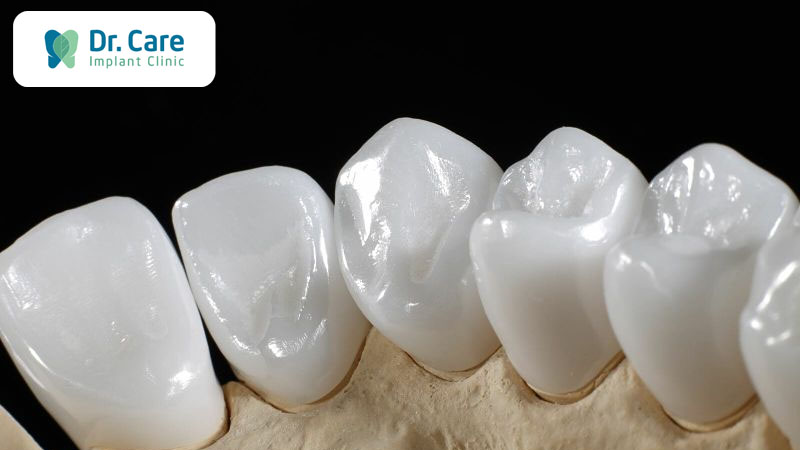 Trồng răng sứ kim loại có bền không? 