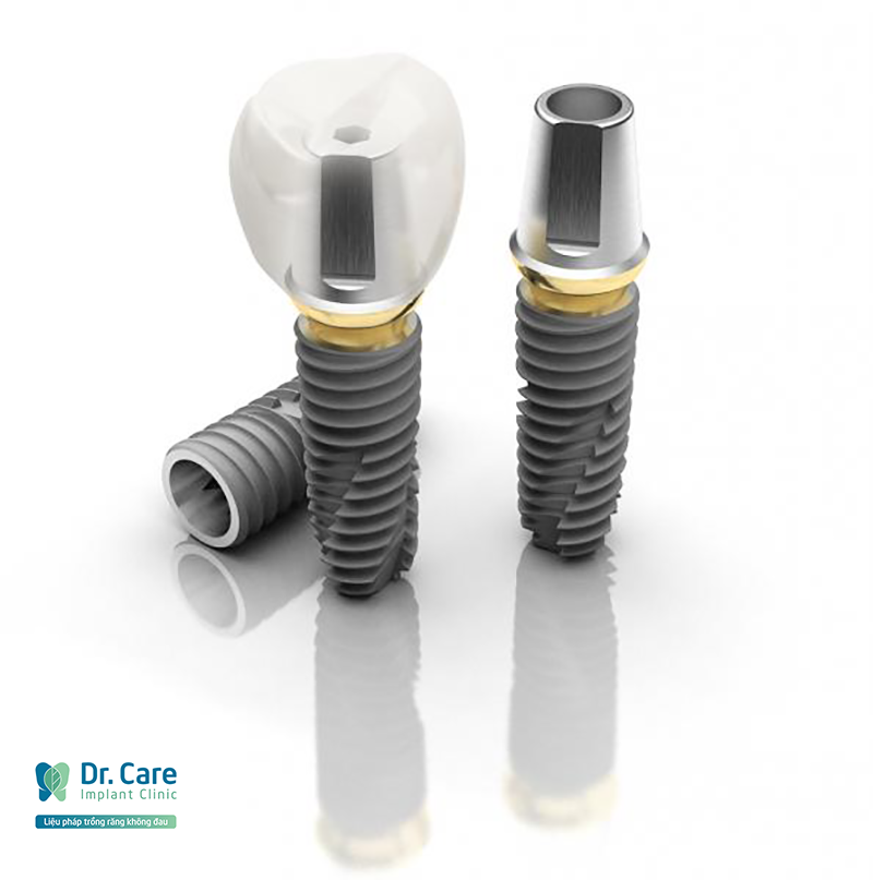 3 cách giúp tuổi thọ răng Implant kéo dài đến trọn đời?