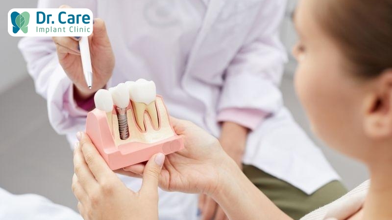 Trồng răng sứ loại nào tốt nhất?