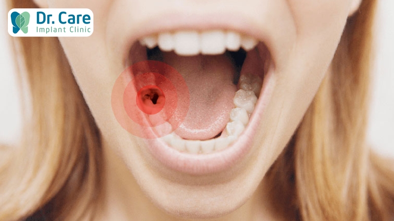Mắc các bệnh lý về răng miệng