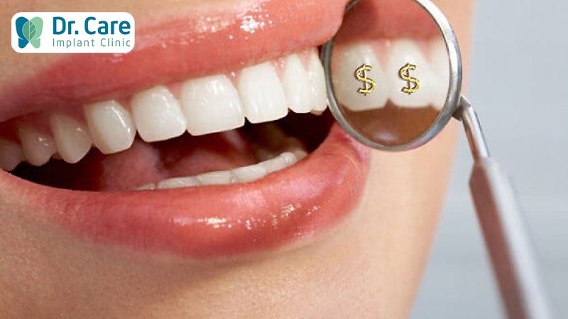 Răng toàn sứ giá bao nhiêu? Bảng giá răng toàn sứ mới nhất