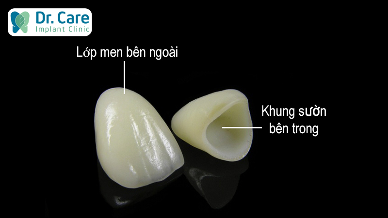 Răng toàn sứ là gì?
