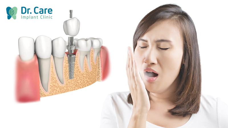 Trồng răng Implant có bị hôi miệng không?