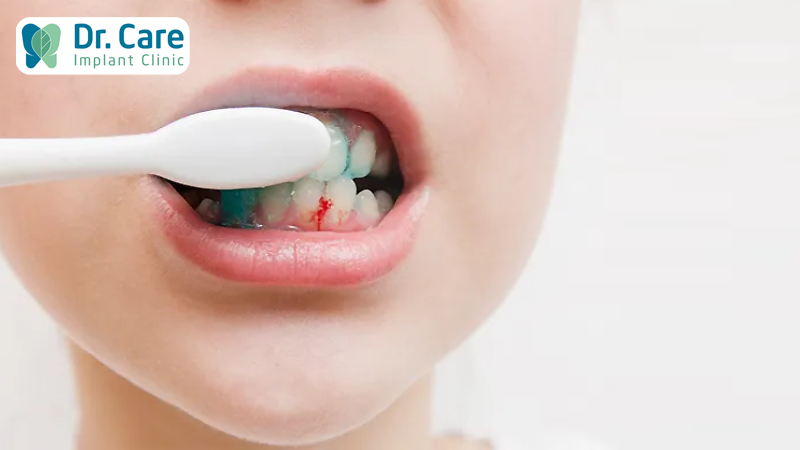 Tình trạng chảy máu nướu răng là như thế nào?