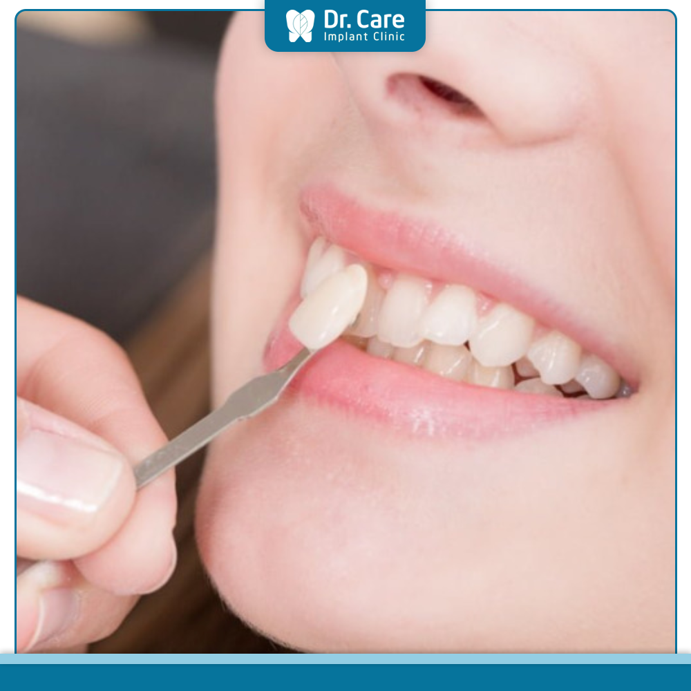 Trường hợp nào thích hợp để bọc răng sứ cải thiện tình trạng răng hô?