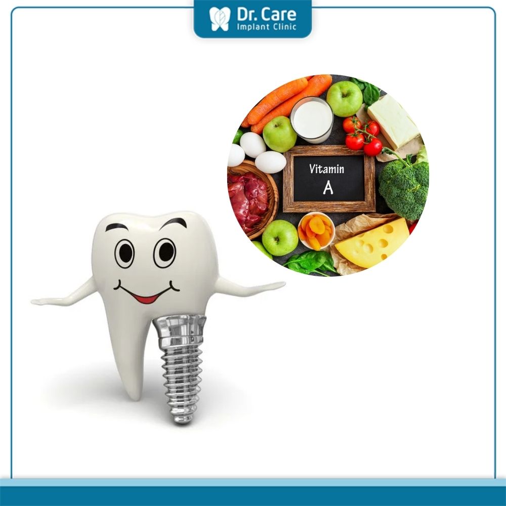 Tầm quan trọng của dinh dưỡng trong quá trình lành thương sau khi cấy ghép Implant