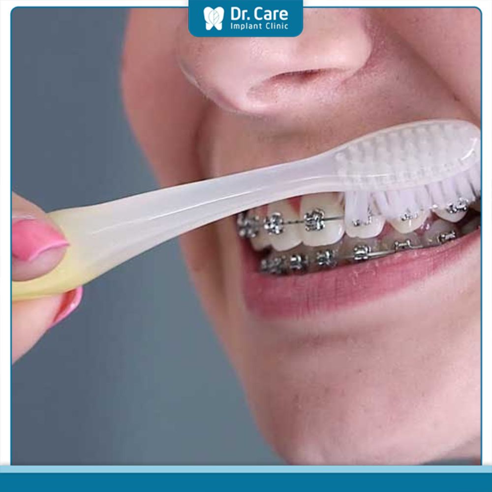 Nguyên nhân dẫn đến tình trạng lợi trùm