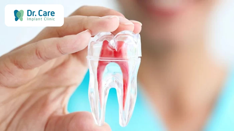 Hướng dẫn cách giảm đau răng sau khi lấy tủy