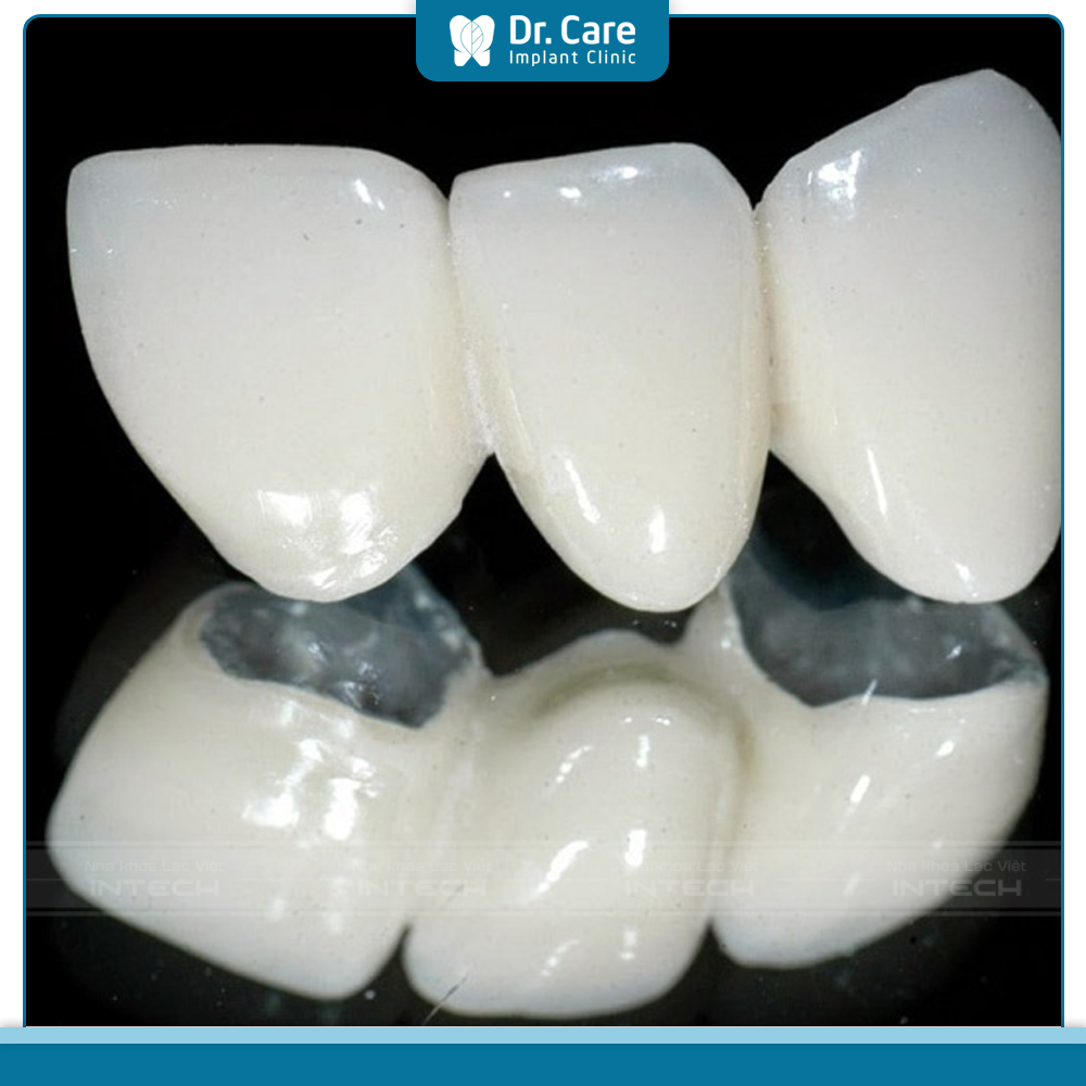 Sử dụng mẫu răng sứ nào phù hợp với răng khểnh