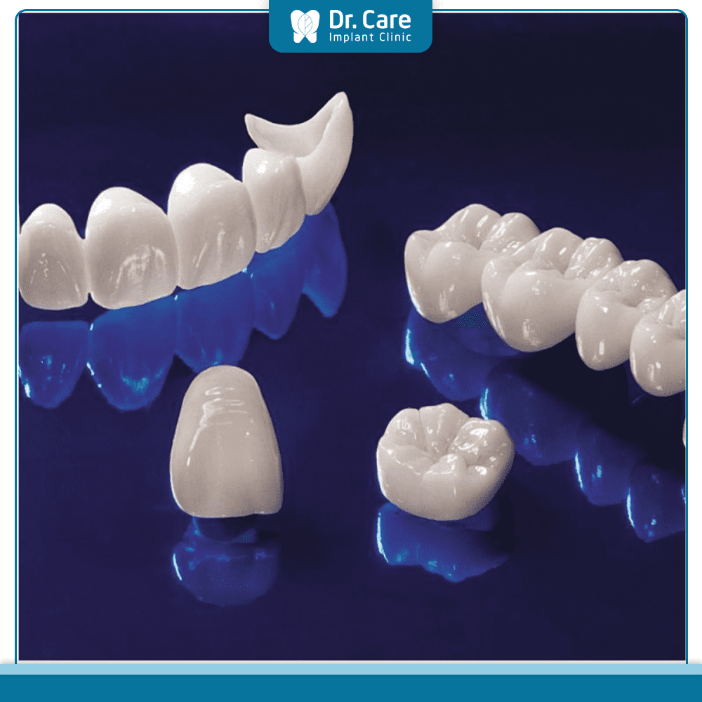 Răng hàm phù hợp với loại răng sứ nào?
