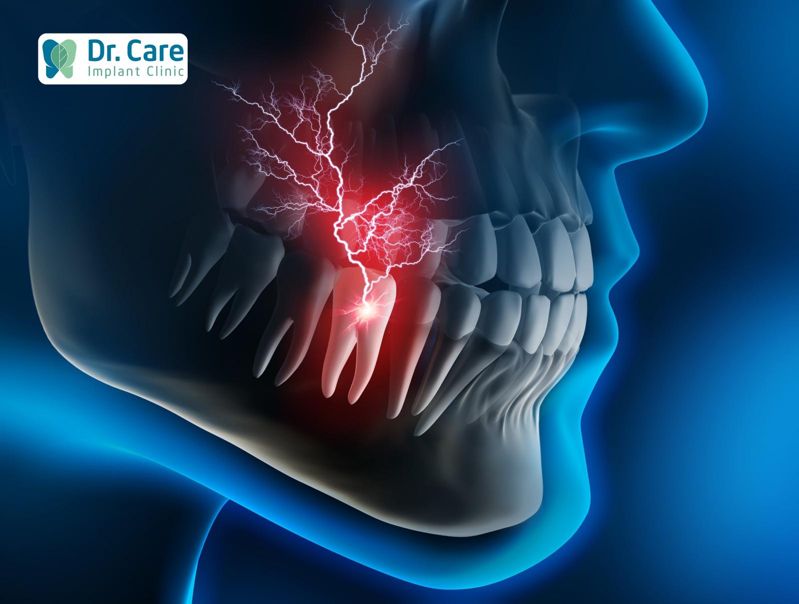 Đau răng trong chẩn đoán nha khoa là gì? Tại sao cơn đau răng lại khó chịu?