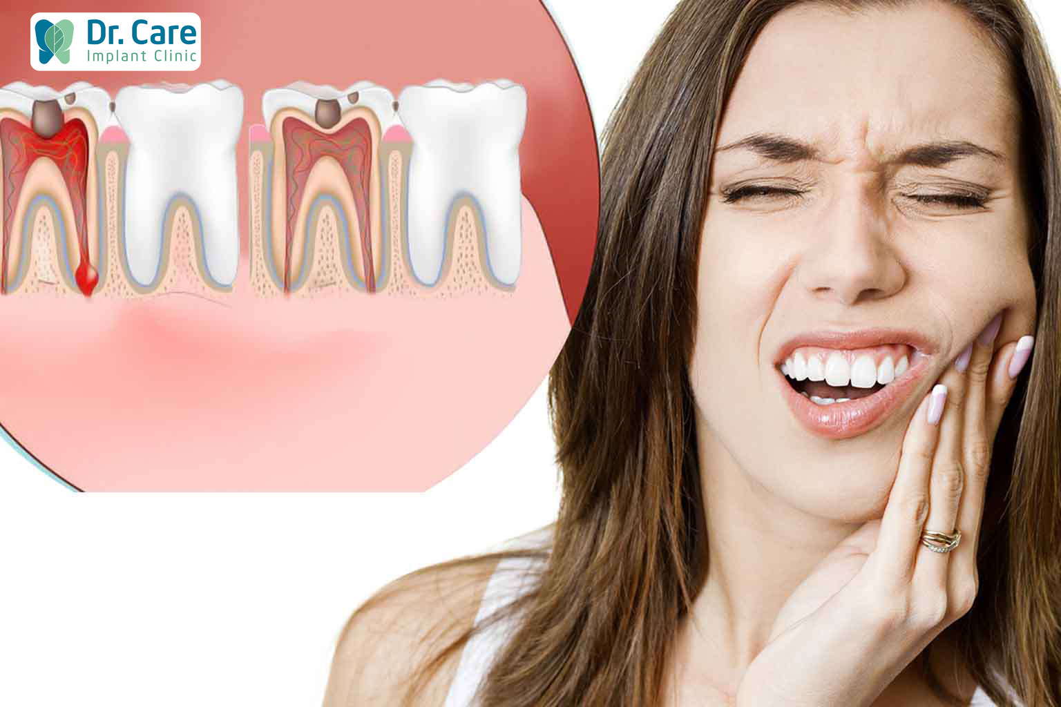 Triệu chứng của những cơn đau răng 