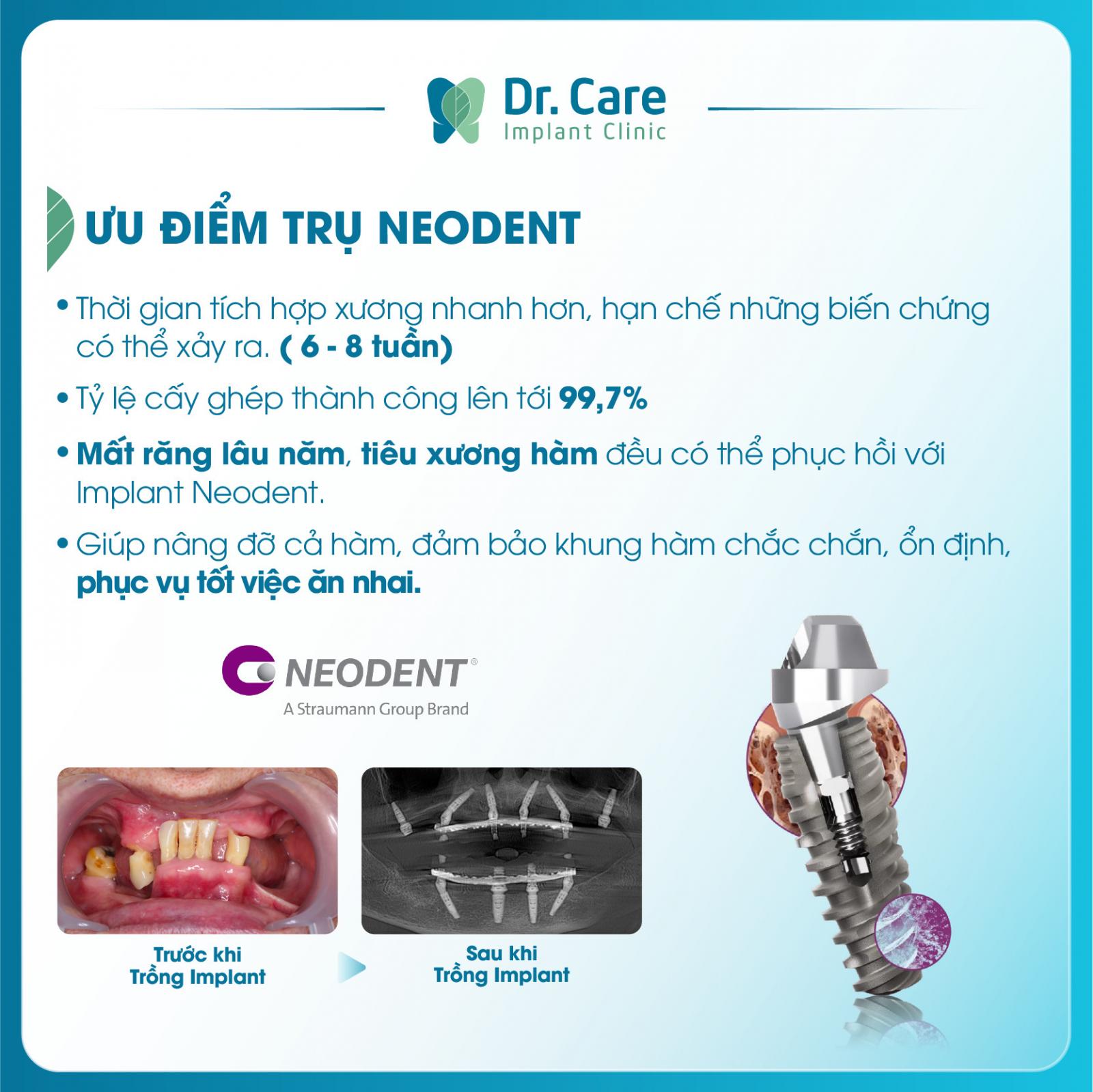 Trụ implant thuỵ sĩ Neodent