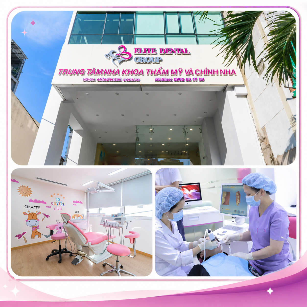 Nha khoa Elite – Nha khoa chuyên sâu cấy ghép Implant tại TPHCM