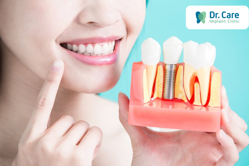 Hướng dẫn chăm sóc mất răng số 4 sau khi cấy Implant
