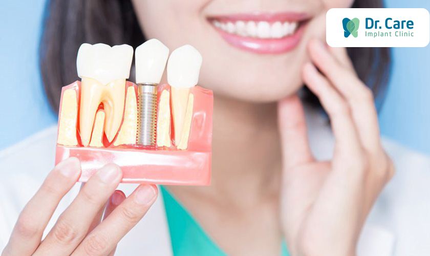 Một số lưu ý khi trồng răng Implant phục hình mất răng số 3
