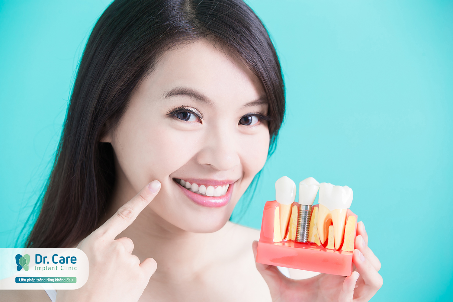 Hiệu quả của việc trồng răng hàm số 6 bằng cấy ghép Implant 