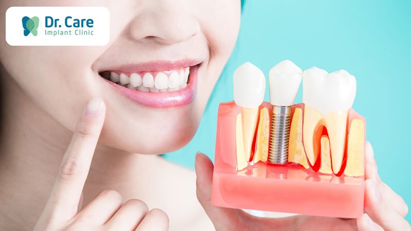 Tại sao trồng răng Implant là phương pháp phục hồi răng đã mất hiệu quả nhất?