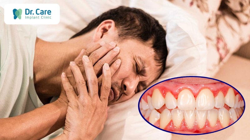 Hậu quả nghiêm trọng do viêm chân răng giả gây ra 