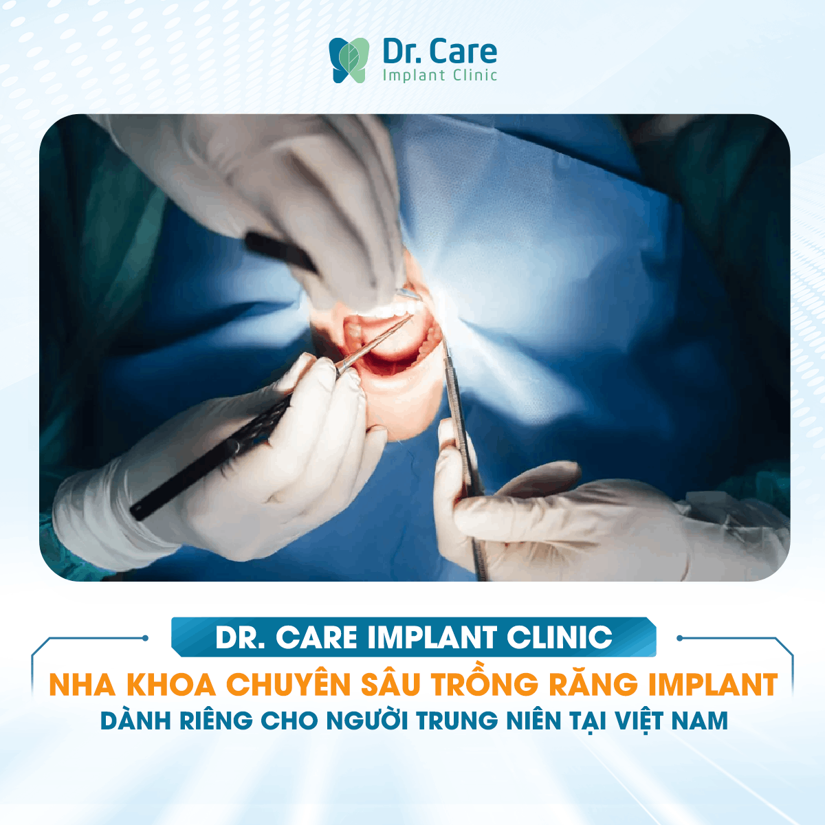 [HỎI ĐÁP BÁC SĨ] - Giữ lại răng khôn bị sâu có gây sâu lan và viêm sang răng số bảy không và khi nào thì phải nhổ dứt điểm để cứu răng bên cạnh