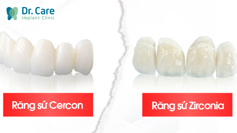 chi phí răng sứ Zirconia và Cercon HT