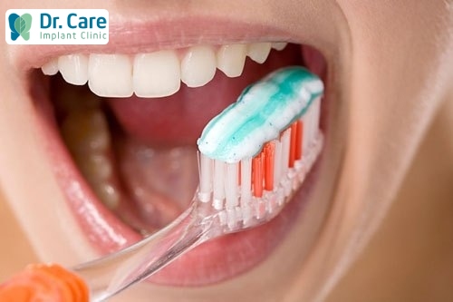 vệ sinh răng miệng cẩn thận sau khi cấy ghép Implant