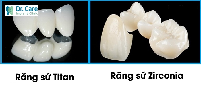 chi phí giữa răng sứ Zirconia và răng sứ Titan