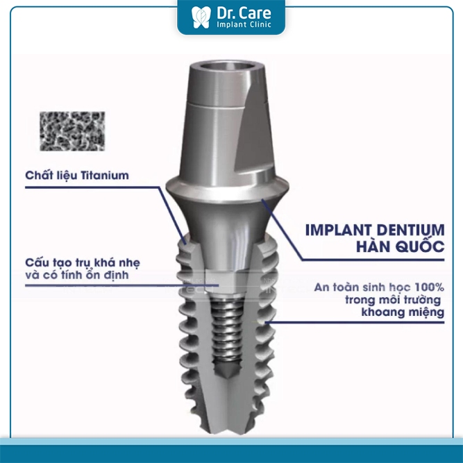 Trụ Implant Dentium Hàn Quốc