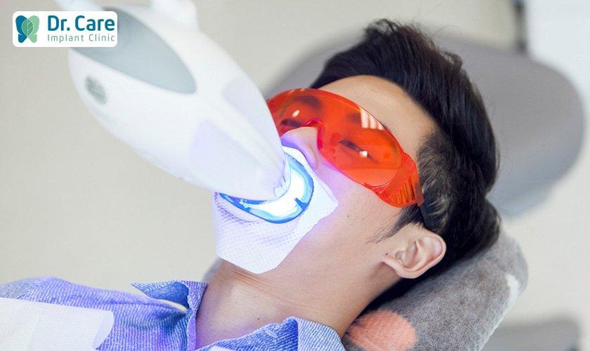 Phương pháp tẩy trắng răng bằng laser