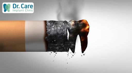 thuốc lá ảnh hưởng tới trồng răng Implant