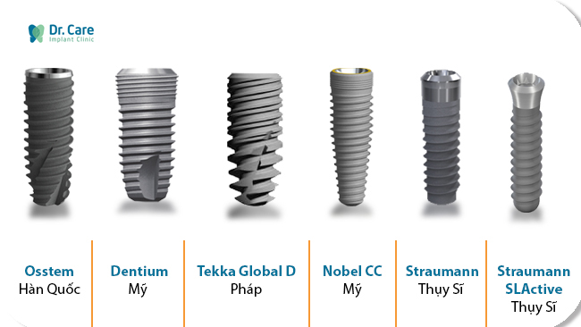 Những loại trụ Implant phổ biến hiện nay được nhiều người sử dụng