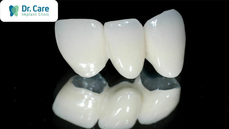 Nhược điểm của răng sứ Ceramill
