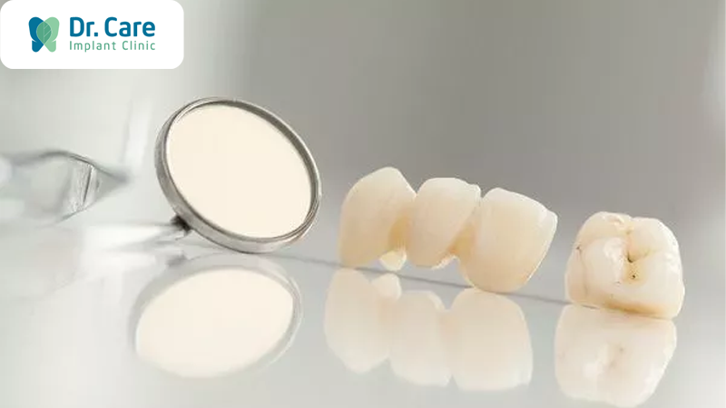 5 Tiêu chí lựa chọn răng sứ chất lượng
