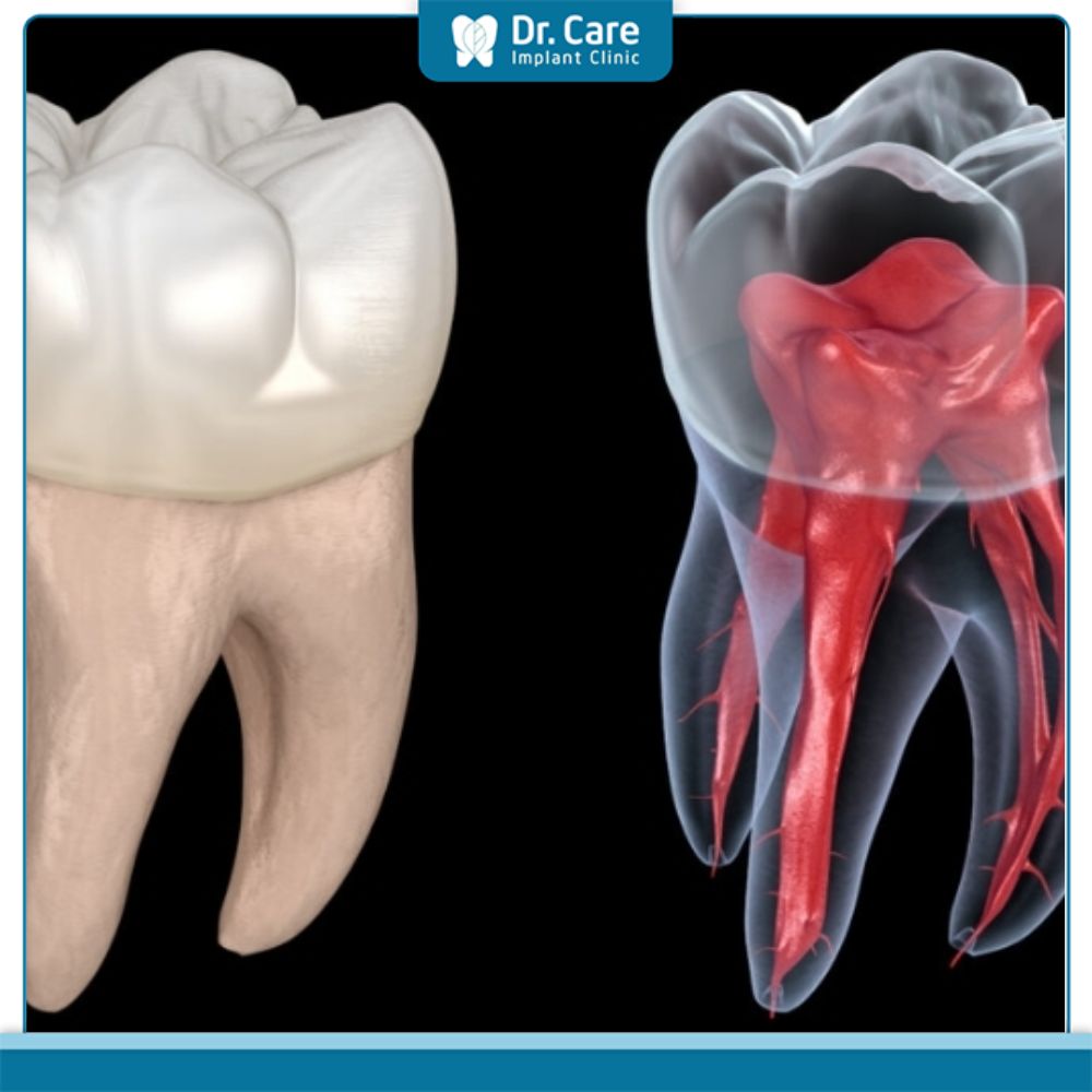 Lấy chỉ máu răng là gì?