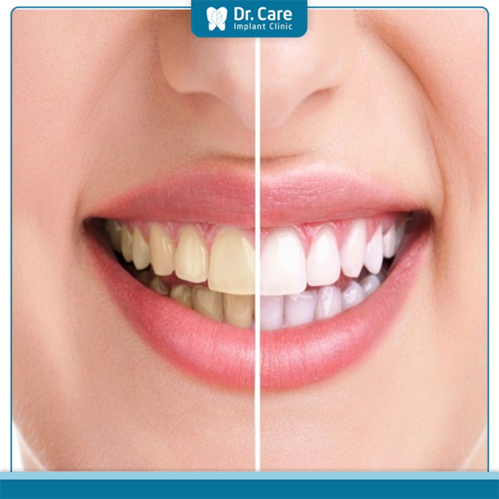 Tác hại khi lấy tủy răng sai cách