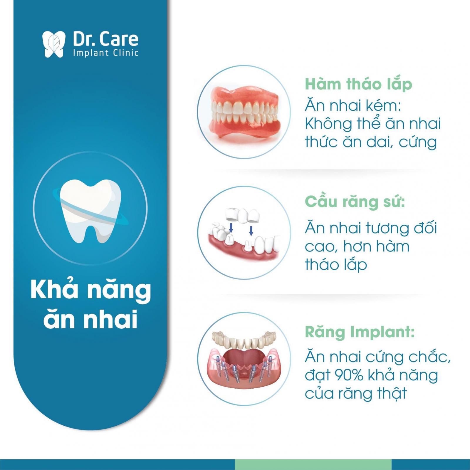 Phương pháp trồng răng Implant khôi phục khả năng ăn nhai