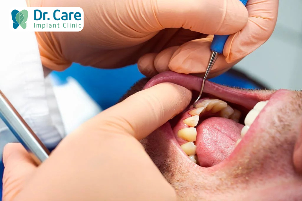 Điều trị viêm nướu răng tại các cơ sở bệnh viện, nha khoa có uy tín
