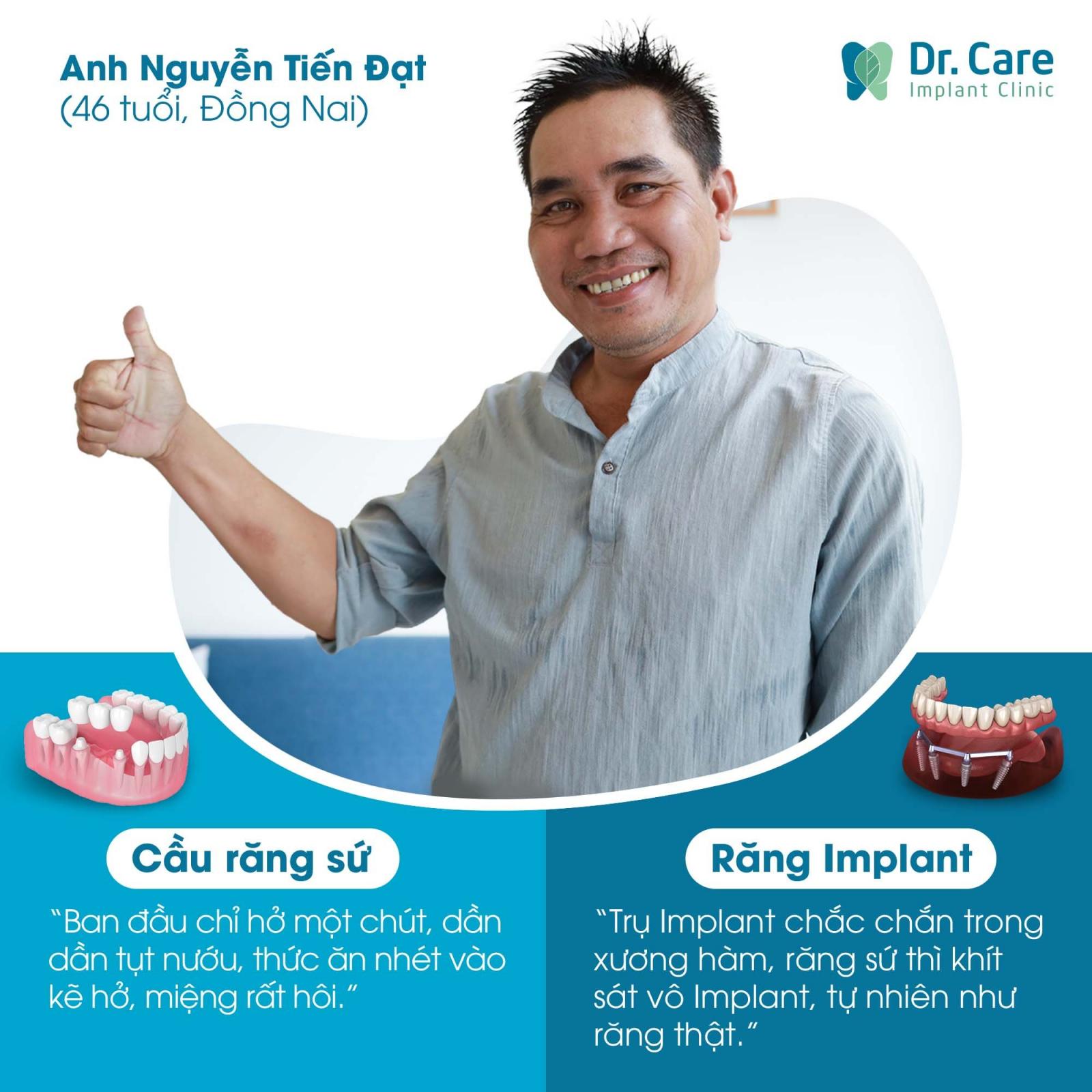 Trồng răng Implant thay bọc răng sứ tại Dr.Care