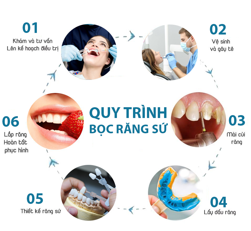 Tham khảo quy trình bọc răng sứ tại nha khoa