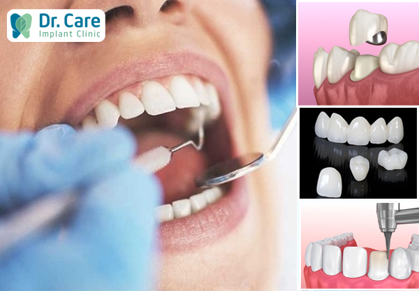 Bọc răng sứ an toàn và chất lượng phụ thuộc vào các yếu tố nào?