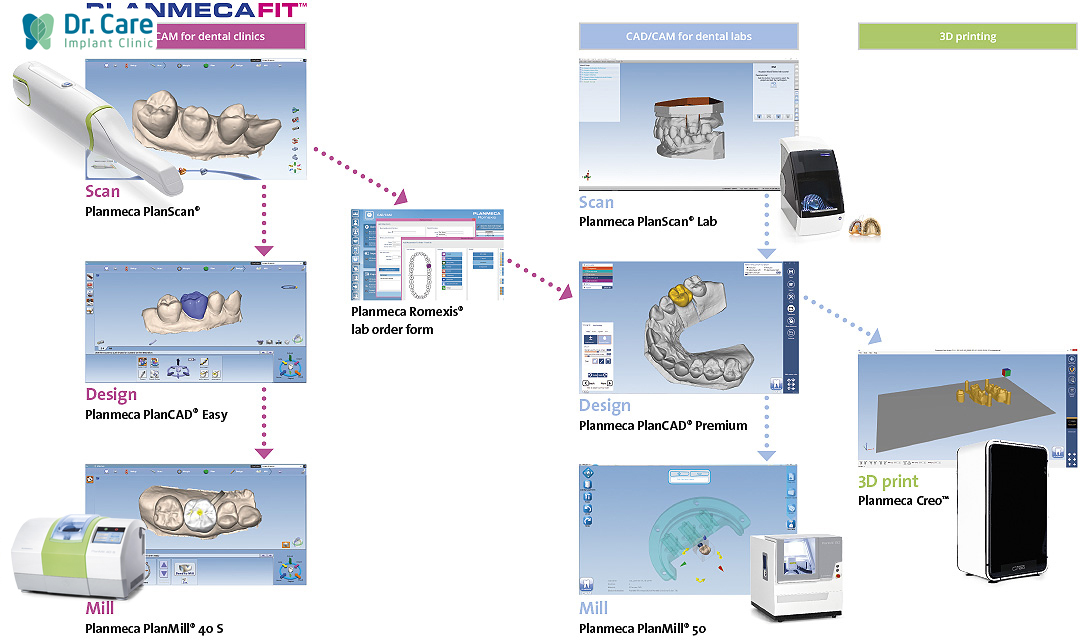 Ứng dụng công nghệ CAD/CAM trong phục hình răng sứ