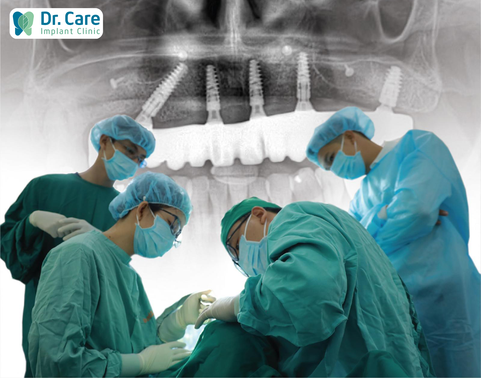 Đội ngũ Bác sĩ chuyên sâu tập trung nghiên cứu và điều trị duy nhất giải pháp Implant