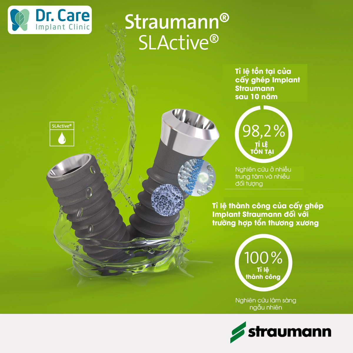 trụ implant straumann