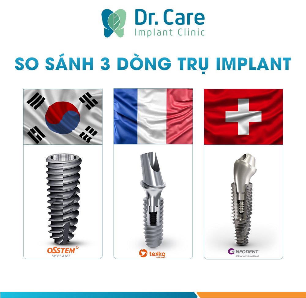 So sánh trụ Implant Hàn Quốc với các dòng trụ Implant Mỹ, Thuỵ Sĩ và trụ Implant Pháp