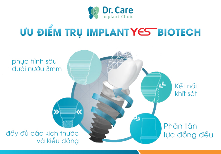 6 ưu điểm nổi bật của trụ Implant Yes Biotech
