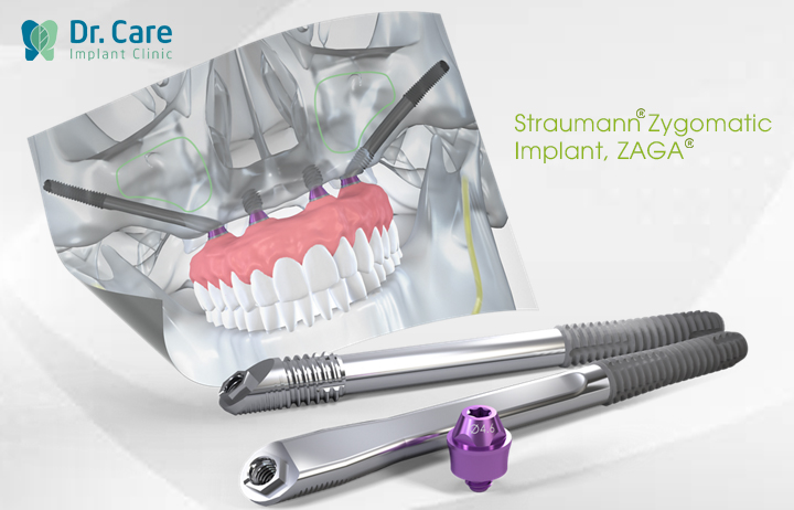 Cấu tạo của trụ Implant Thụy Sĩ Straumann