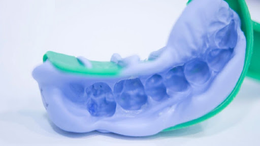Nguyên nhân gây đau răng sau khi trồng Implant