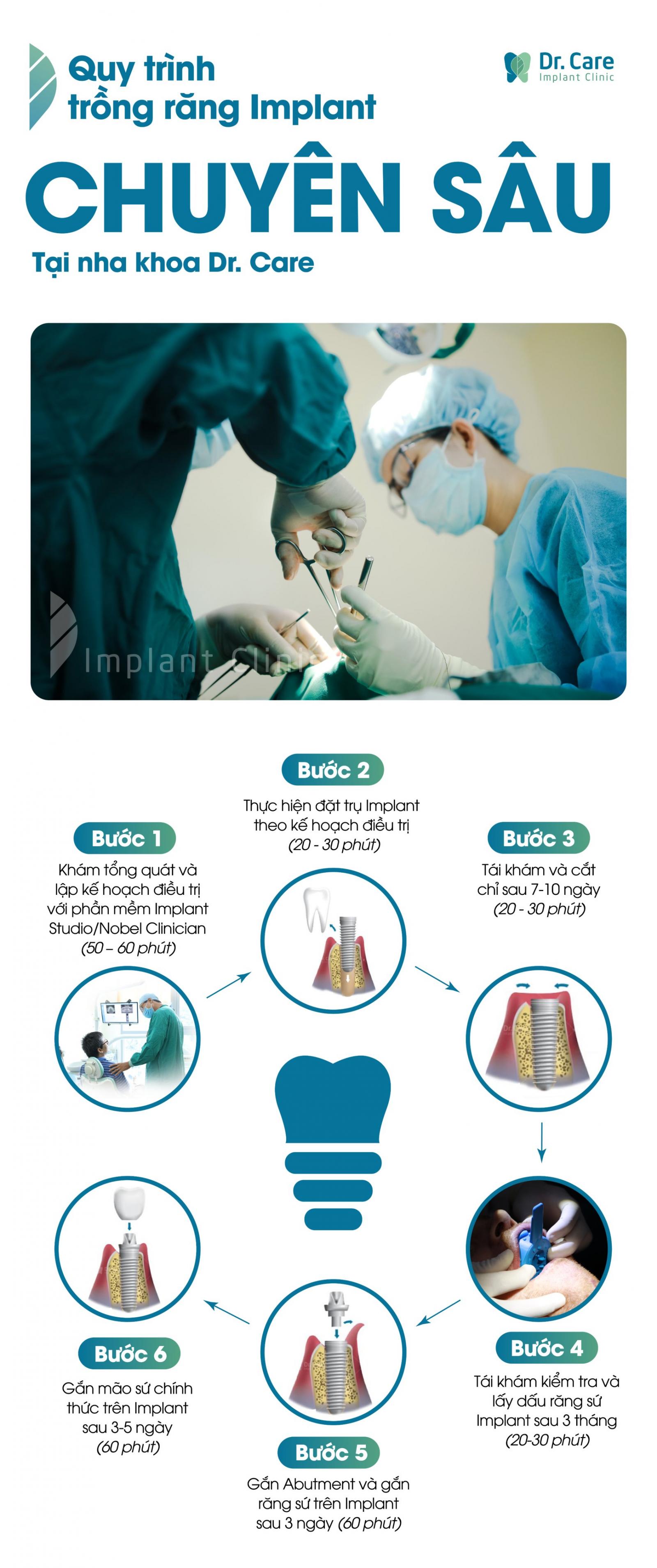 Quy trình trồng răng Implant tại nha khoa Dr. Care bao gồm các bước sau: